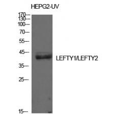 Anti-Lefty antibody