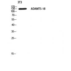 Anti-ADAMTS-18 antibody