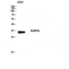 Anti-ASAH3L antibody