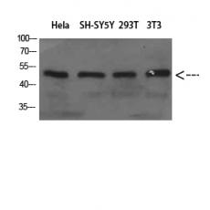 Anti-WIPI1 antibody