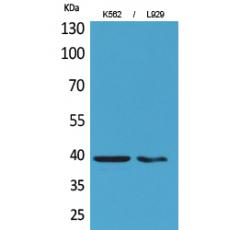 Anti-CD84 antibody