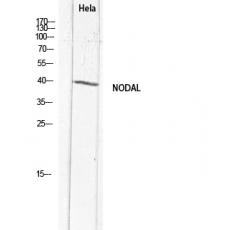 Anti-Nodal antibody