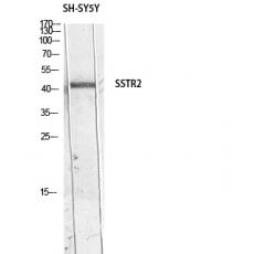 Anti-SSTR2 antibody