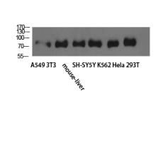 Anti-TLE1/2/3/4 antibody