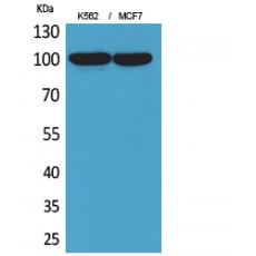 Anti-CD203c antibody