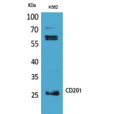 Anti-CD201 antibody