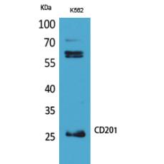Anti-CD201 antibody