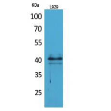 Anti-CKR-4 antibody