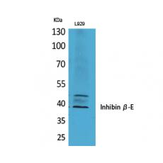 Anti-Inhibin β-E antibody