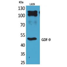 Anti-GDF-9 antibody