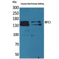 Anti-RFC1 antibody