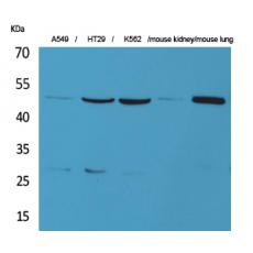 Anti-GDI-2 antibody