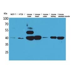 Anti-IDH3A antibody