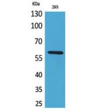 Anti-ALPP/ALPPL2 antibody