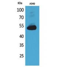 Anti-Annexin VII antibody