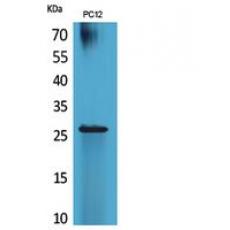 Anti-POLR3G antibody