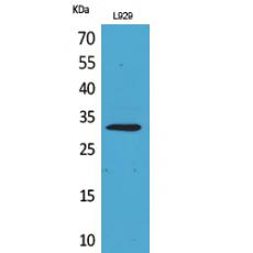 Anti-KLF13 antibody