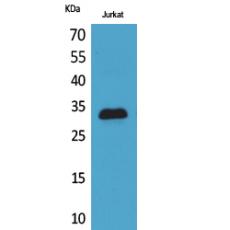 Anti-p57 antibody