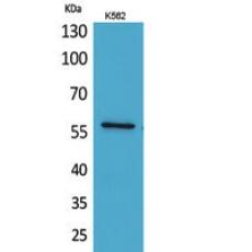 Anti-Angptl1 antibody