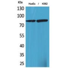 Anti-17β-HSD4 antibody