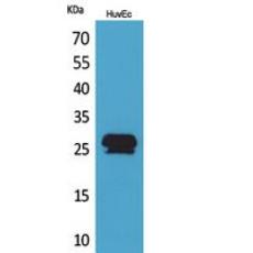Anti-CacyBP antibody