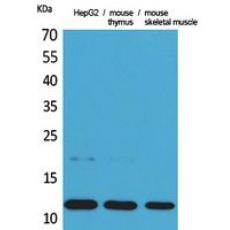 Anti-Eotaxin antibody