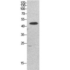 Anti-EF-1 α1/2 antibody