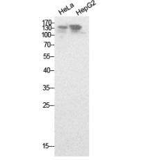 Anti-NCoA-3 antibody