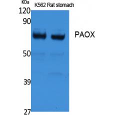 Anti-PAOX antibody