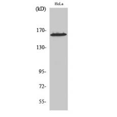 Anti-ZNF608 antibody