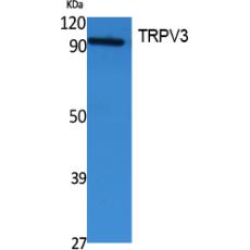 Anti-TRPV3 antibody