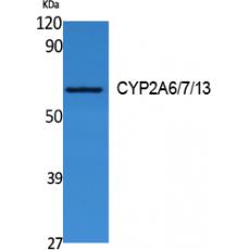 Anti-CYP2A6/7/13 antibody