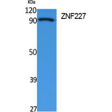 Anti-ZNF227 antibody