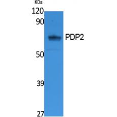 Anti-PDP2 antibody