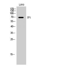 Anti-ZP1 antibody