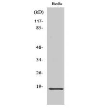 Anti-ZNHIT1 antibody