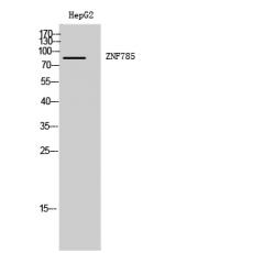 Anti-ZNF785 antibody