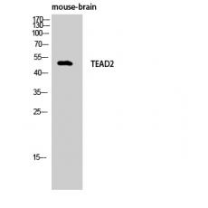 Anti-TEF-4 antibody