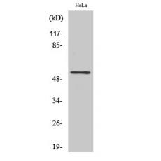 Anti-TFDP1 antibody