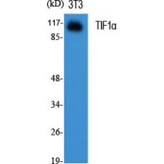 Anti-TIF1α antibody