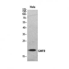 Anti-GMF-β antibody
