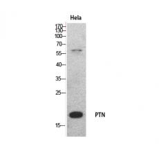 Anti-PTN antibody