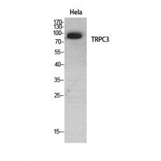 Anti-TRPC3 antibody