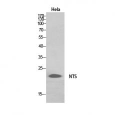 Anti-Neurotensin antibody