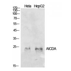 Anti-AID antibody