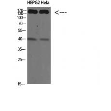 Anti-CYFIP2 antibody