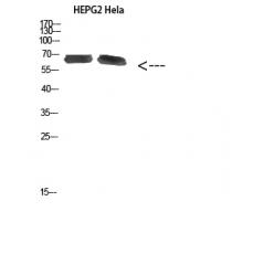 Anti-NOP56 antibody