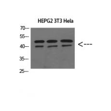 Anti-ERLIN1/2 antibody