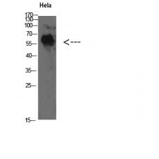 Anti-TyrRS antibody