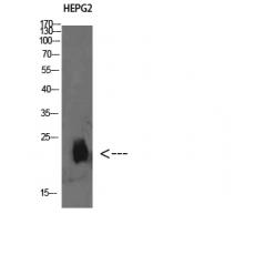 Anti-Plasminogen receptor antibody